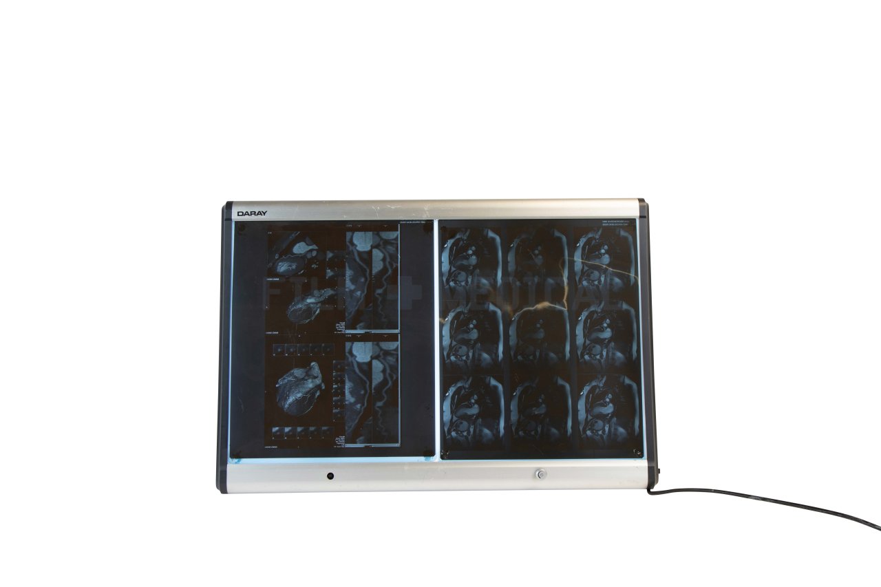 Double Wall Mount Light Box X Rays priced Separately FILM MEDICAL